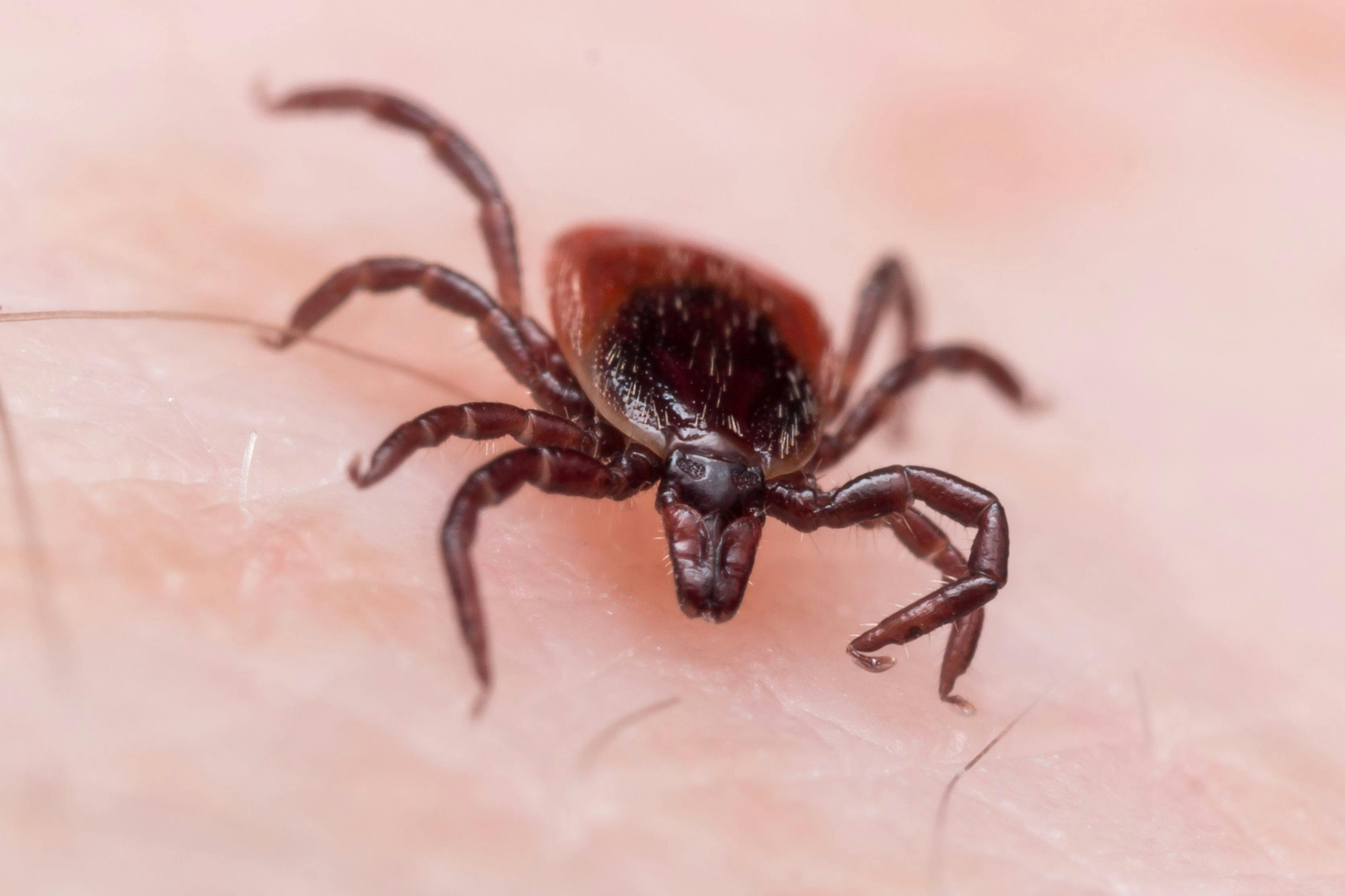 Lyme Disease: A Catch-up Quiz