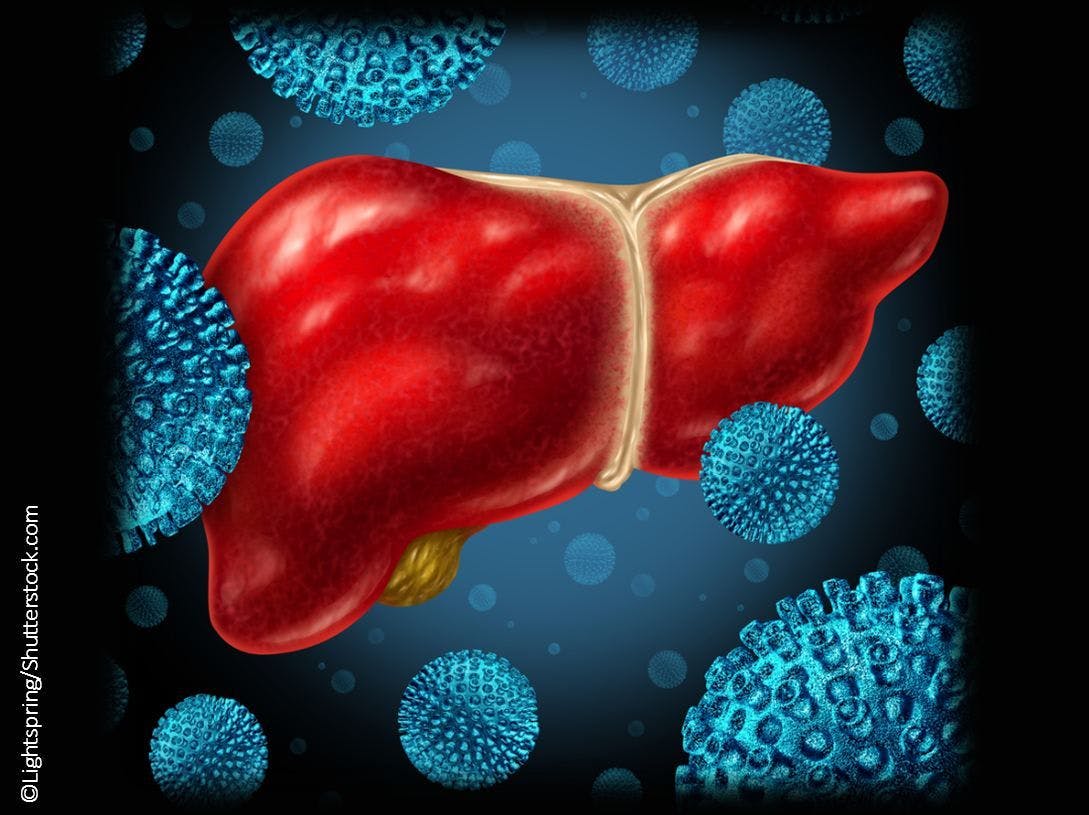 Direct-Acting Antivirals Tied to Lower Risk of Liver Cancer in HCV